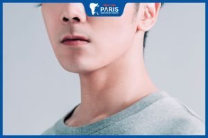 Độn cằm nam giá bao nhiêu, Phương pháp độn cằm cho nam giới