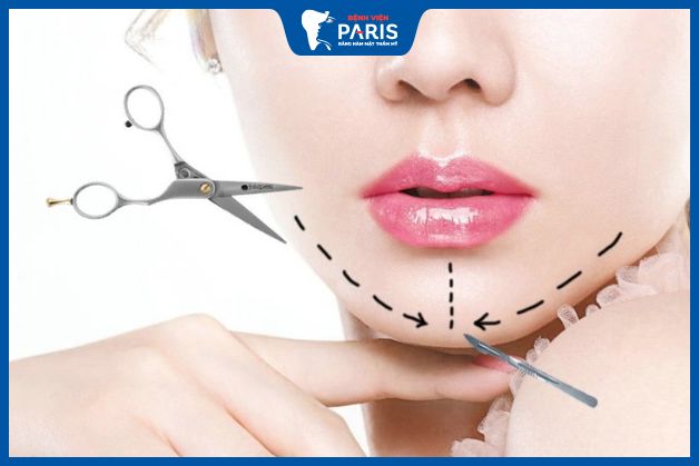 Độn cằm phong thủy có giúp thay đổi vận mệnh không