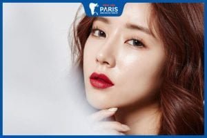 Độn cằm sau 1 tháng – Tăng độ đầy đặn 80% với phương pháp mới