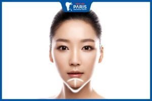 Độn cằm sau 10 ngày – 8 lưu ý quan trọng để Hồi phục nhanh chóng