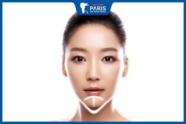 Độn cằm sau 3 tháng đã đẹp chưa