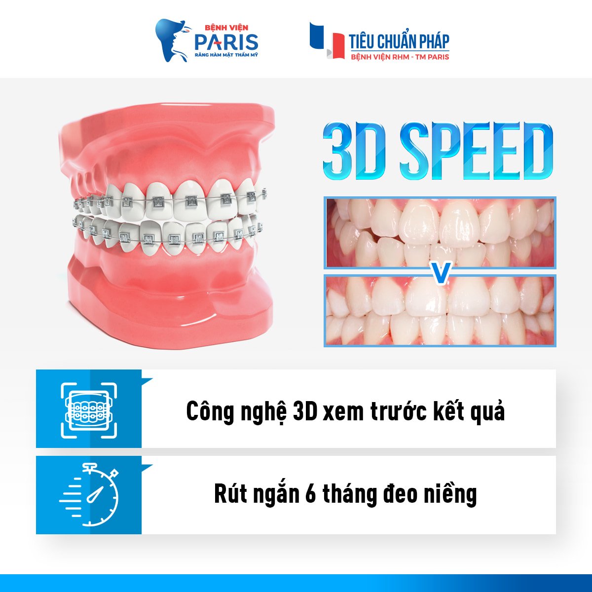 Công nghệ xem trước kết quả