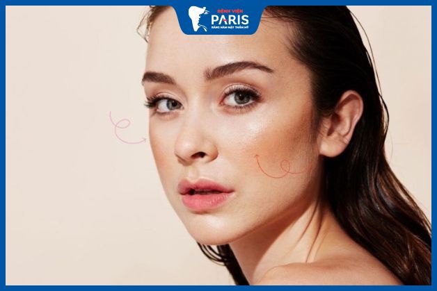 Phẫu thuật hạ gò má phù hợp với người có gò má cao