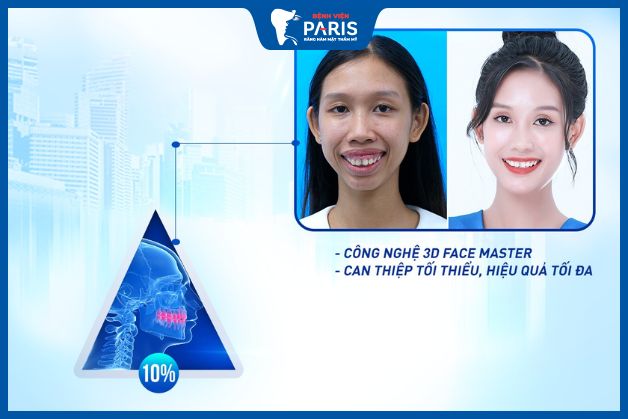 Công nghệ 3D Face Master giúp nâng cao hiệu quả của quá trình phẫu thuật hàm hô