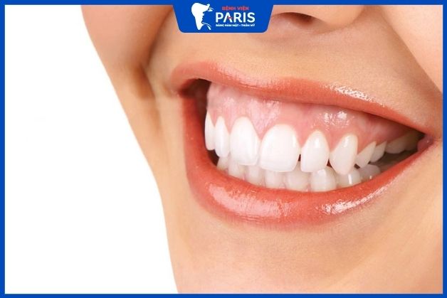Cười bị hở lợi là tốt hay xấu