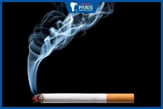 Người mới tạo cằm chẻ không nên hút thuốc